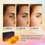 Kojic Acid Dark Spot Remover Soap Bars with Vitamin C, Retinol, Collagen, Turmeric - Original Japanese Complex (2 Pack)